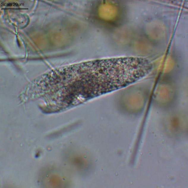 Altra Stylonychia diversamente abile?